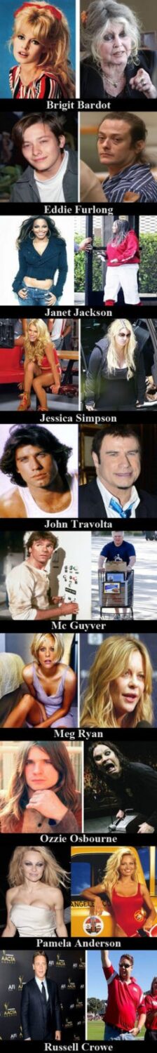 Top 10 badly aging celebrities