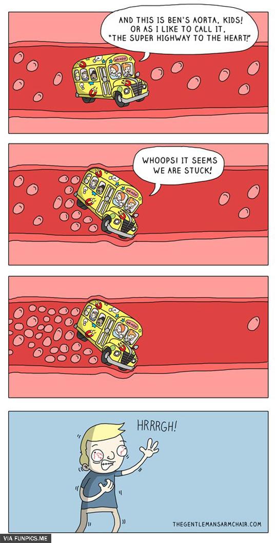 The bus trip in Ben’s Aorta